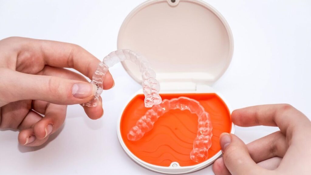 Contenção Invisalign