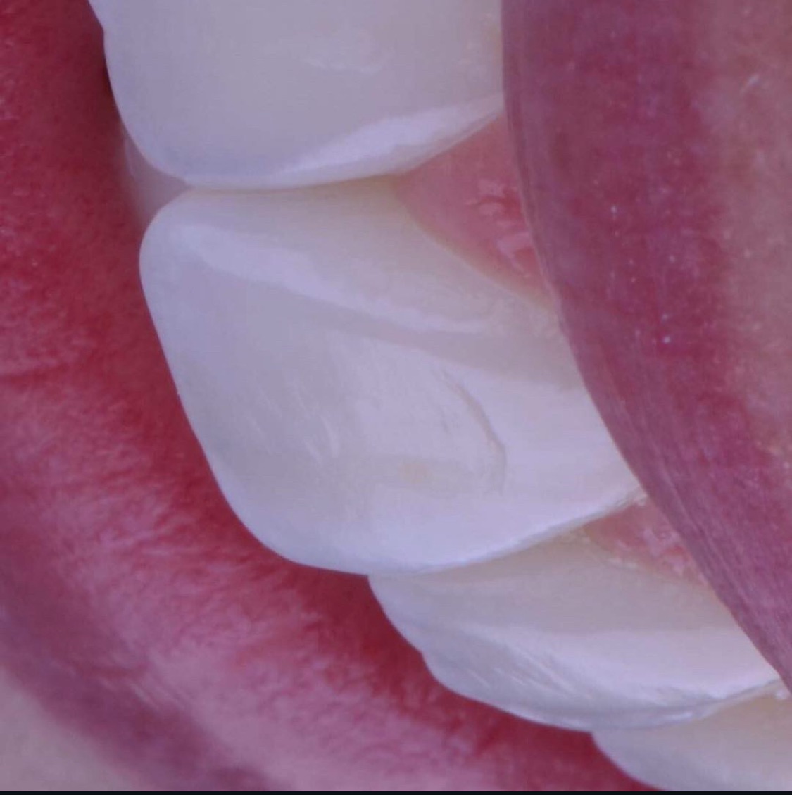 Qual a opção que descreve melhor o meu sorriso?!