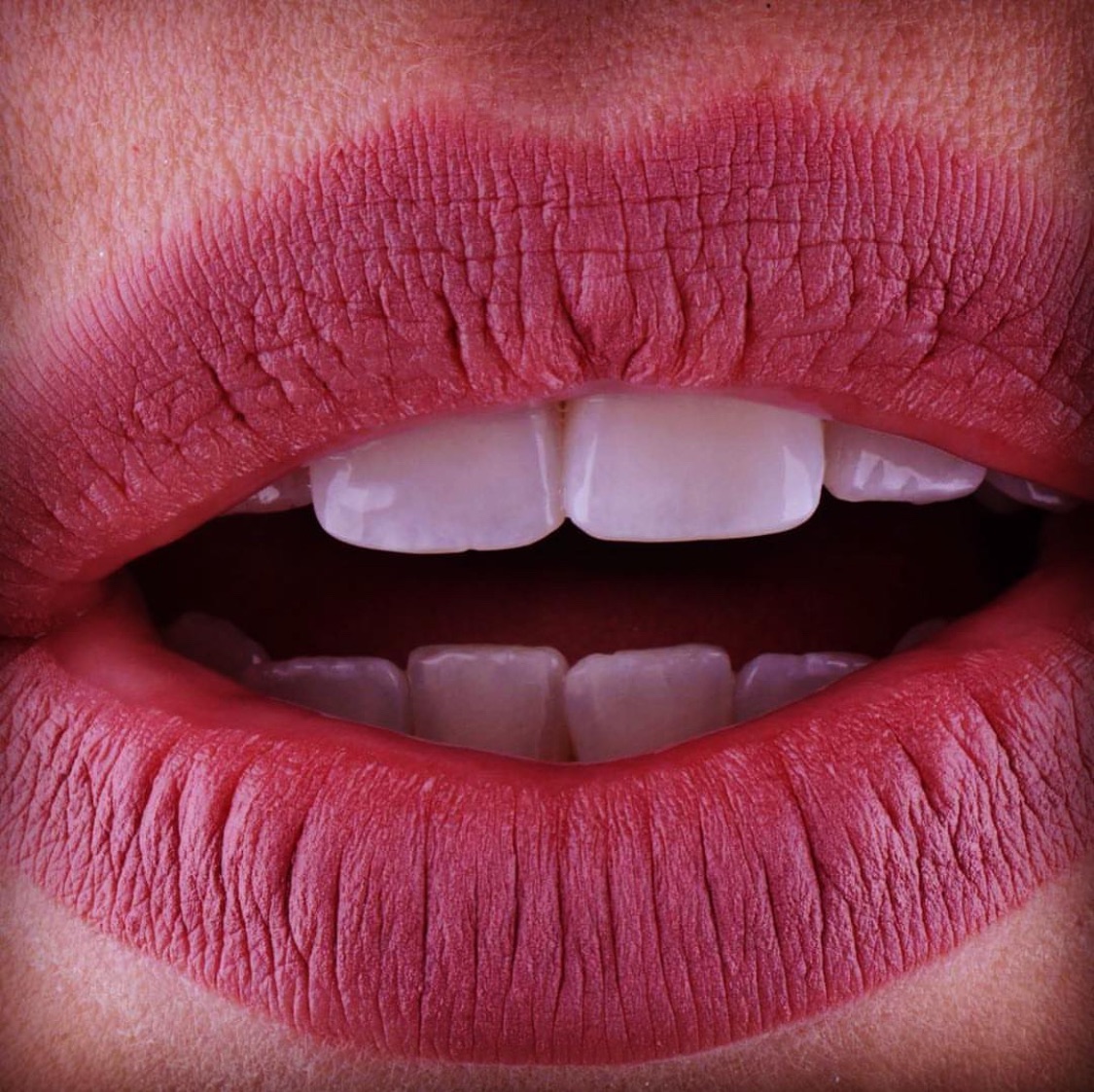 Invisalign para Adultos