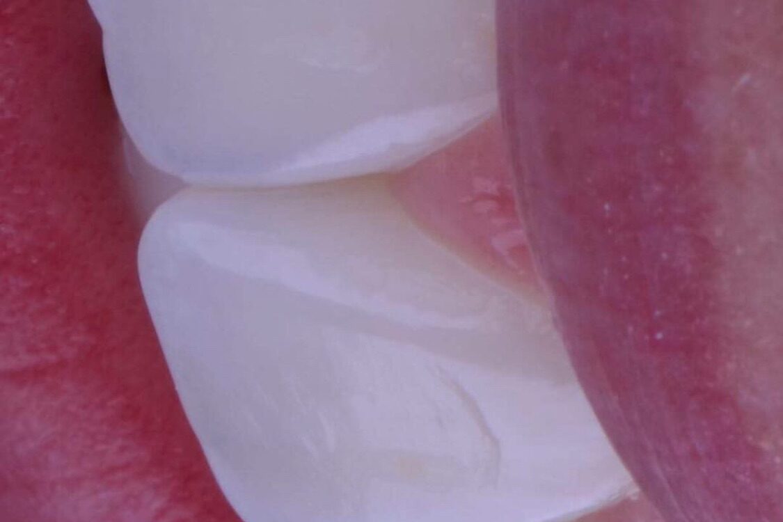 Qual a opção que descreve melhor o meu sorriso?!