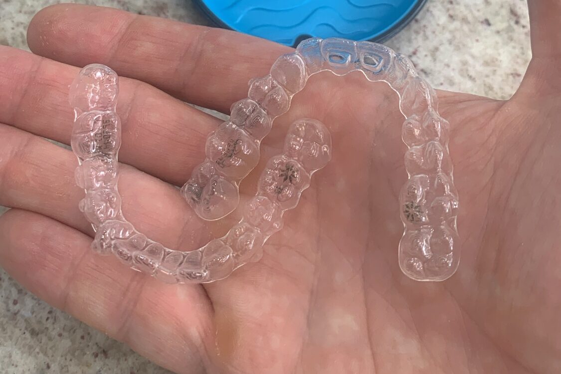 Como limpar o invisalign