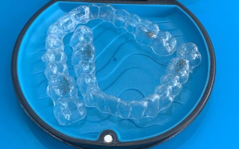 Perguntas sobre o Invisalign