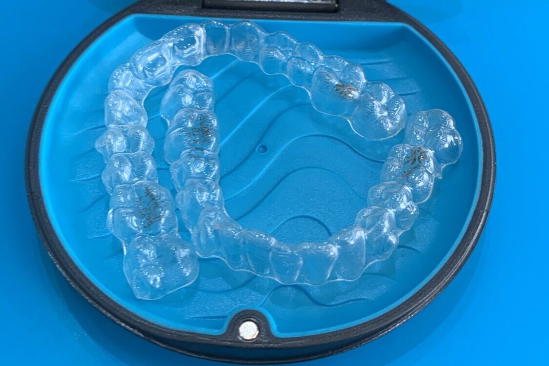 Perguntas sobre o Invisalign