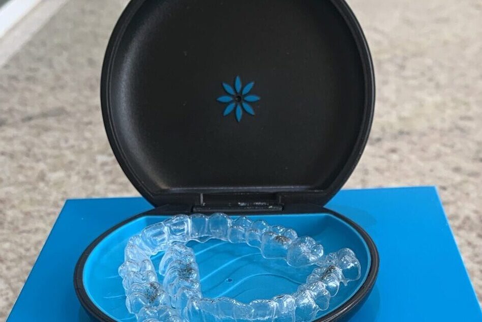 a diferença Invisalign